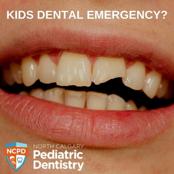 calgary ne kids dental emergency dentist