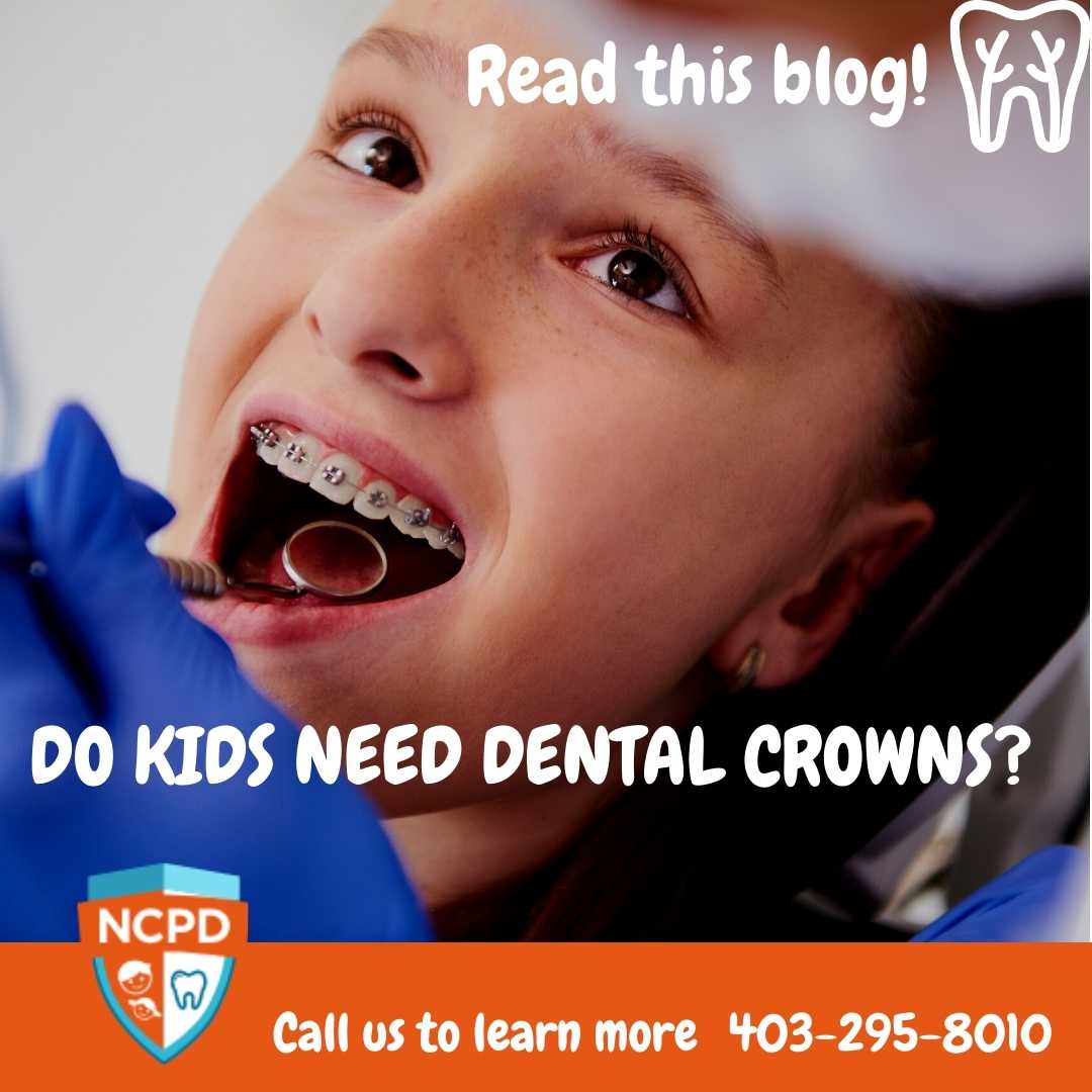 kids dental crown calgary ne
